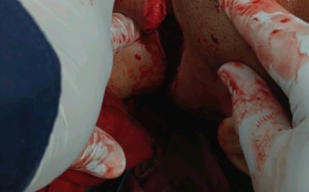 पोलीस उप निरीक्षक दीपक उत्तमराव पारदे  त्यांच्या मोटरसायकल वरून दैनंदिन ड्युटीवर करिता येत असताना त्यांचा गळा नायलॉन मांजा ने कापून गंभीर जखमी झाले होते.